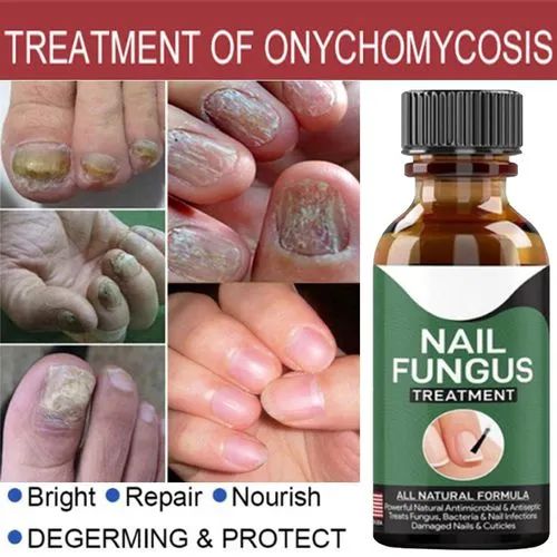 Nail Fungal Essences Serum