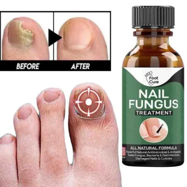 Nail Fungal Essences Serum