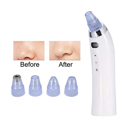 Derma Suction Vacuum Blackhead Remover