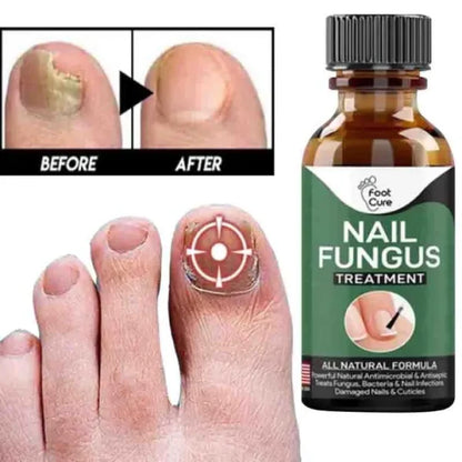 Nail Fungal Essences Serum